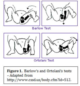 Barlow-Ortolani - GP Exams