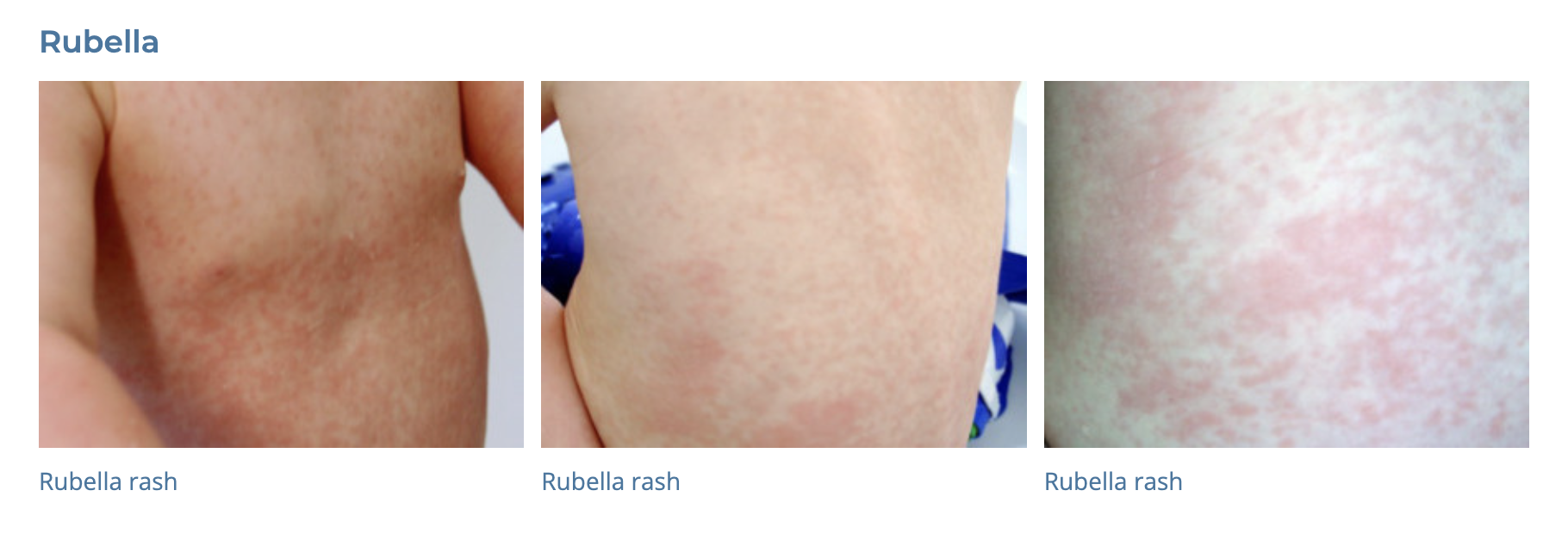 Skin Symptom NOS - GP Exams