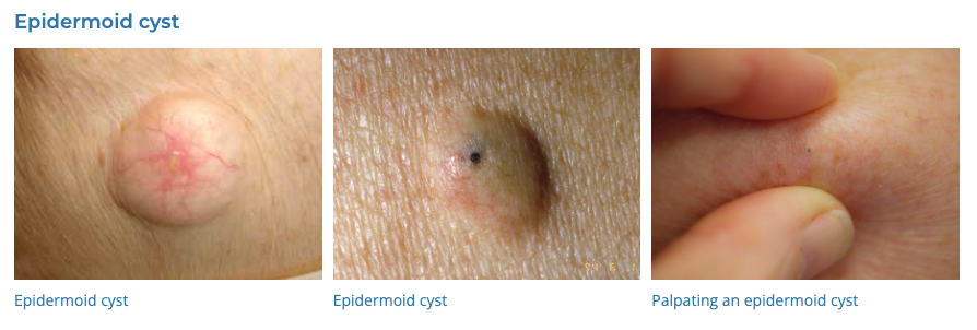 Dermatology 101 Conditions 21 40 GP Exams